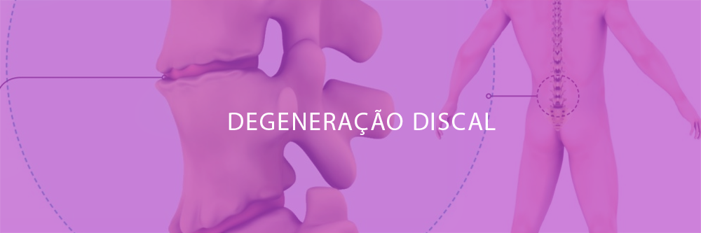 Tratamento para Degeneração Discal